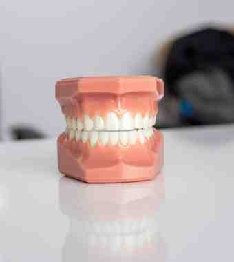 dentures
