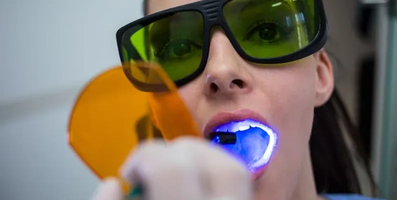 Laser Gum Contouring in Ottawa and Orleans for a Confident Smile