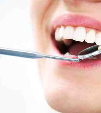 oral cancer screening