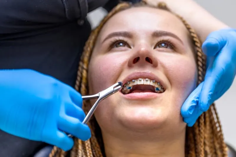 orthodontic treatment in Ottawa and Orleans