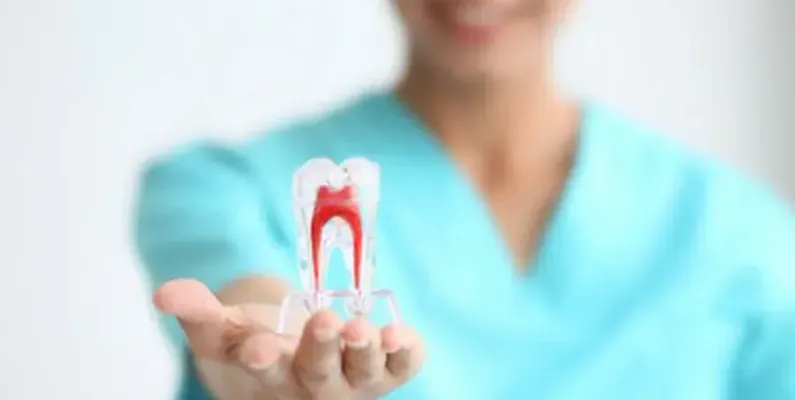 Root Canal
