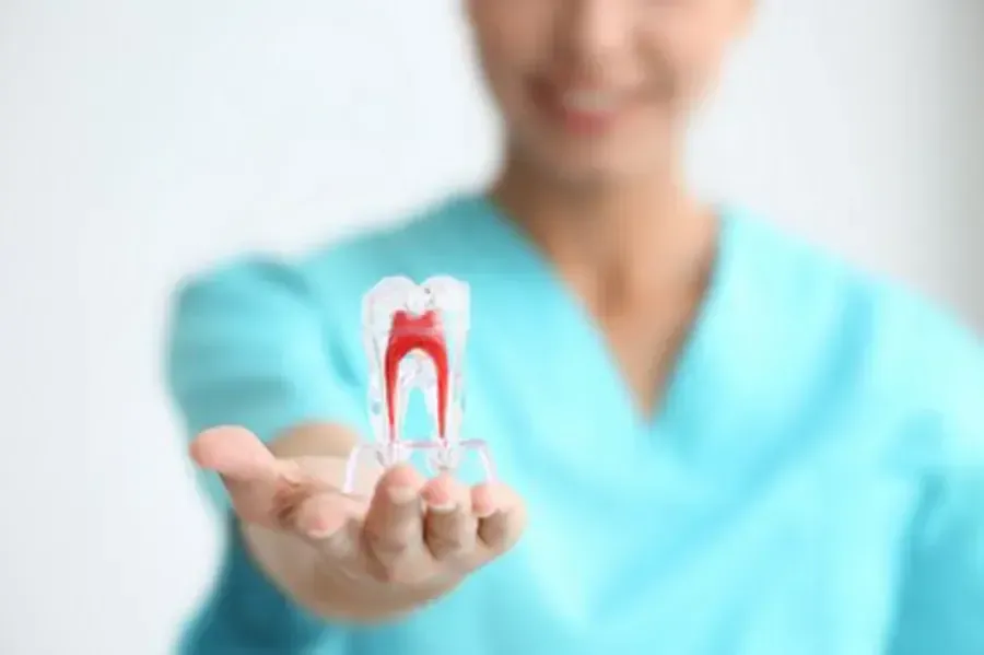 Root Canal