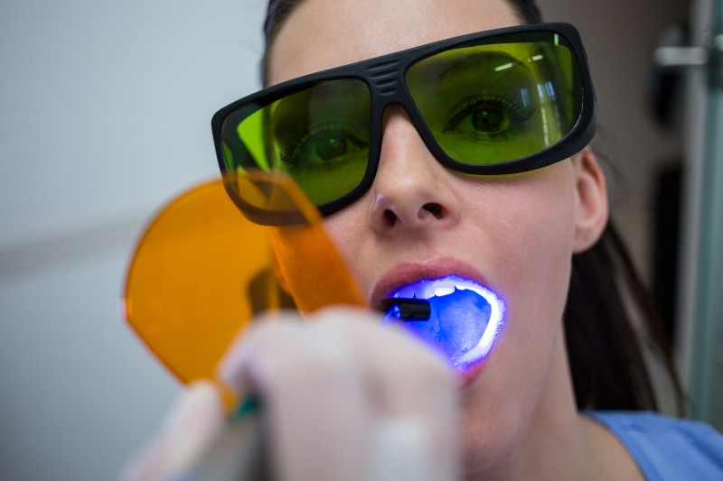 Laser Gum Contouring in Ottawa and Orleans for a Confident Smile